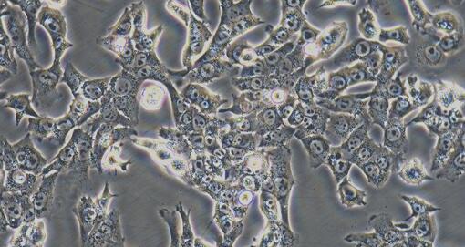 Mouse Hepatocellular Carcinoma Cells (HCC)