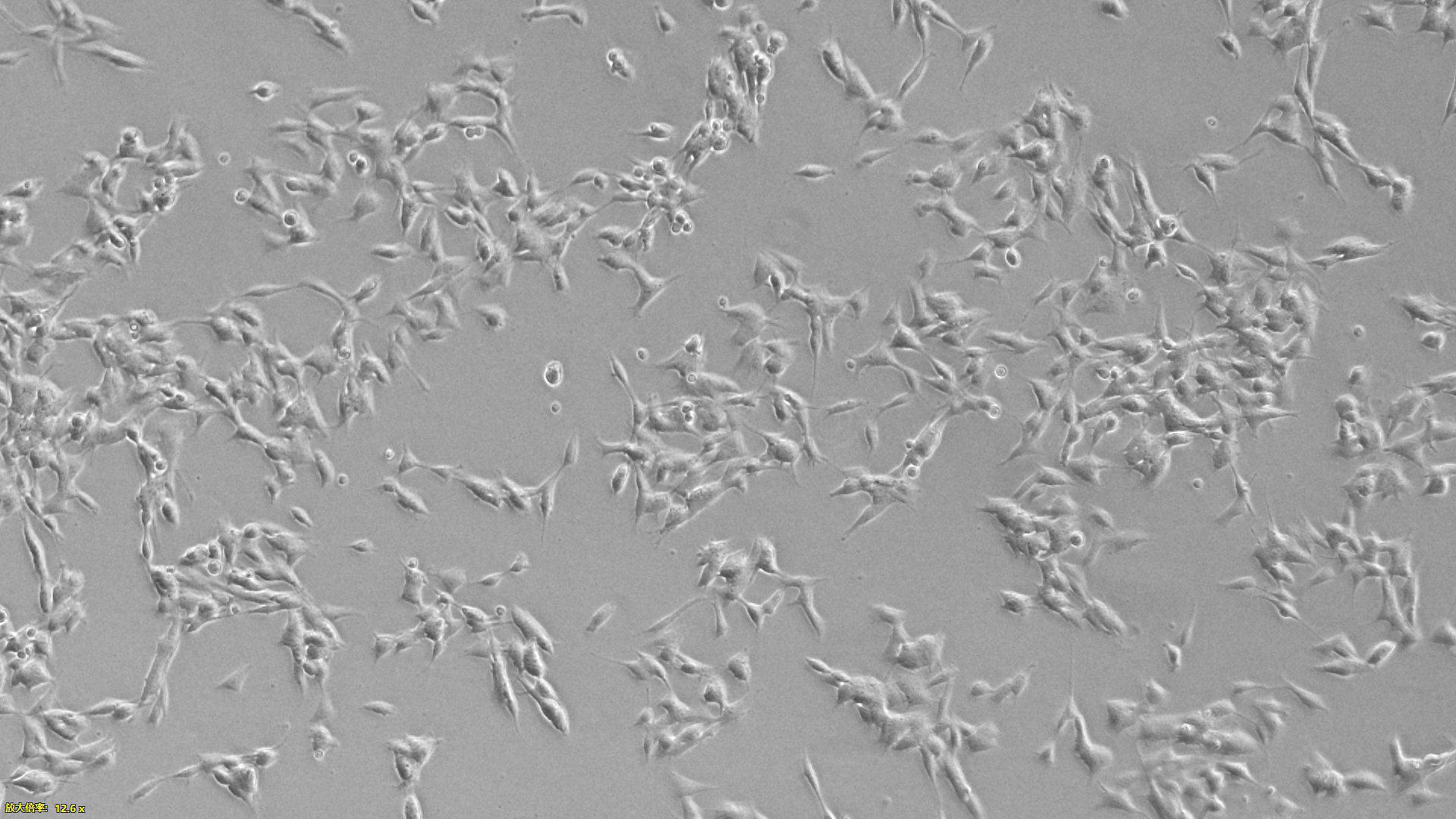 Human Neuroblastoma Cells (NBC)