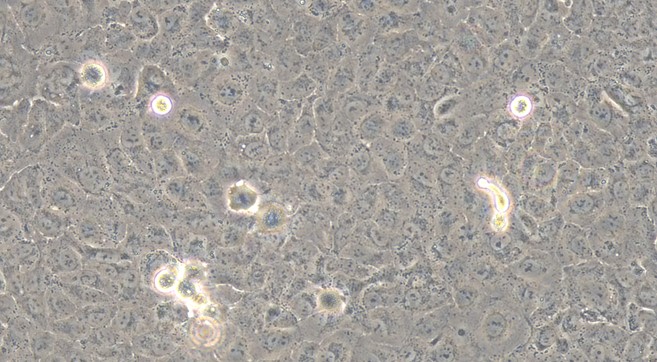 Human Prostate Cancer Cells (PCC)