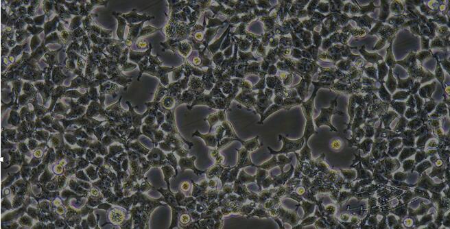 Human Embryonic Kidney Epithelial Cells (EKE)