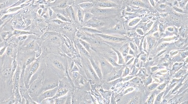 Primary Mouse Embryonic Kidney Epithelial Cells (EKE)