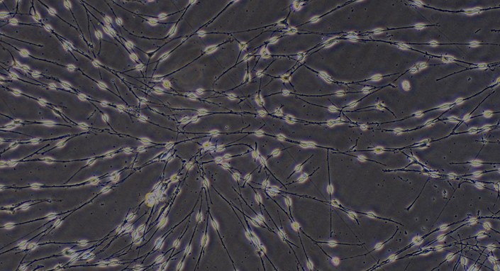 Primary Mouse Trigeminal ganglion neuron cells (TGN)