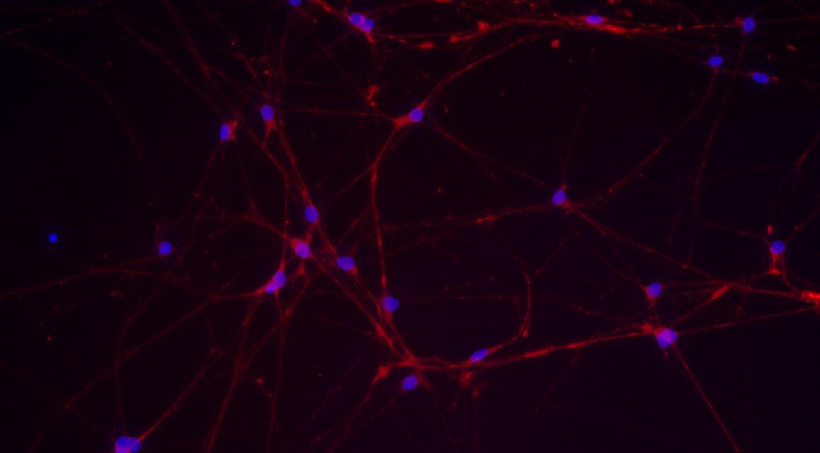 Primary Rat Trigeminal ganglion neuron cells (TGN)