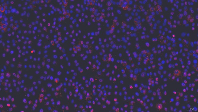 Primary Rat Ovarian Granulosa Cells (OGC)