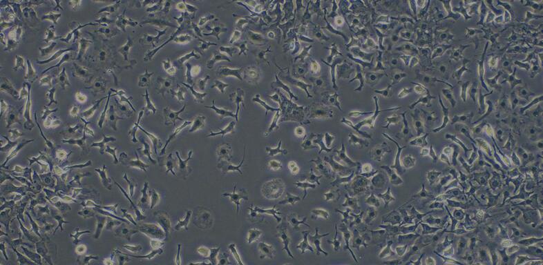 Primary Mouse Thymic Macrophages (TM)