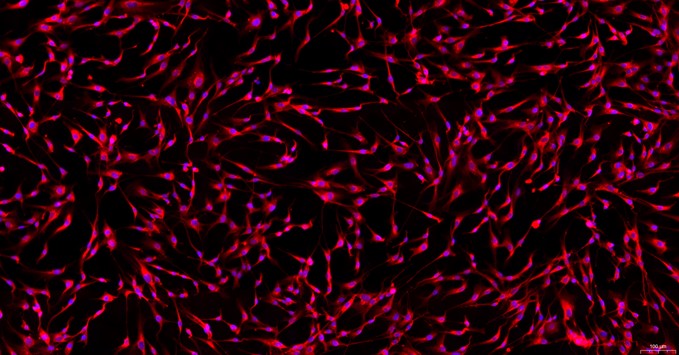 Primary Rat Tendon Cells (TC)