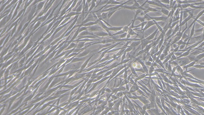 Primary Canine Corneal Stromal cells (CSC)