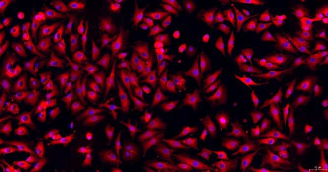 Primary Caprine Corneal Stromal cells (CSC)