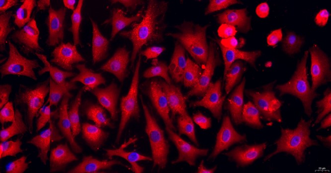 Primary Caprine Corneal Stromal cells (CSC)