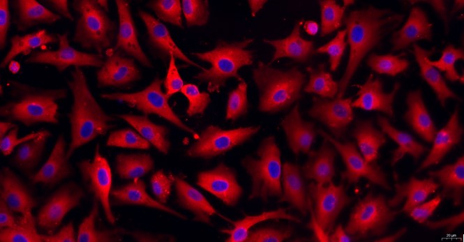 Primary Caprine Corneal Stromal cells (CSC)