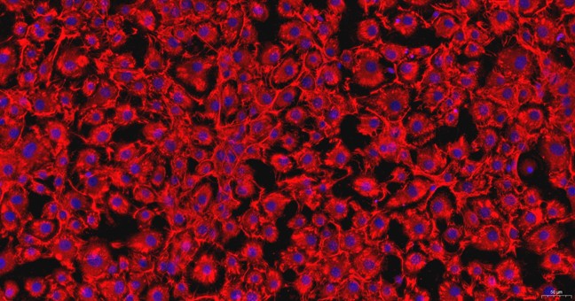 Primary Mouse Corneal Stromal cells (CSC)