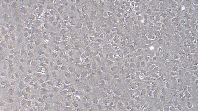 Primary Mouse Corneal Stromal cells (CSC)