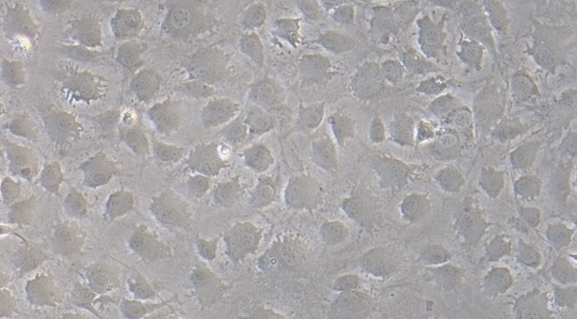 Primary Mouse Corneal Stromal cells (CSC)