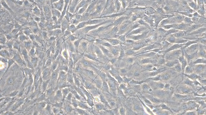 Primary Rat Corneal Stromal cells (CSC)