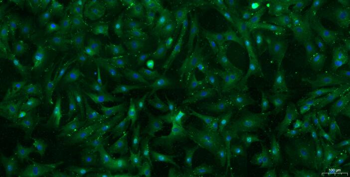 Primary Caprine Tendon Stem Cells ( TDSC)