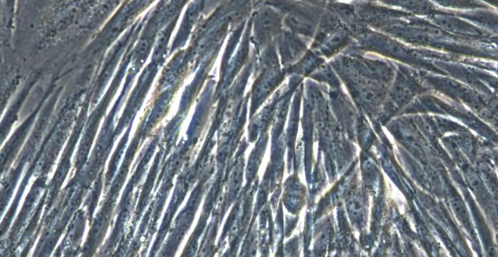Primary Canine Pancreatic Fibroblasts (PNF)
