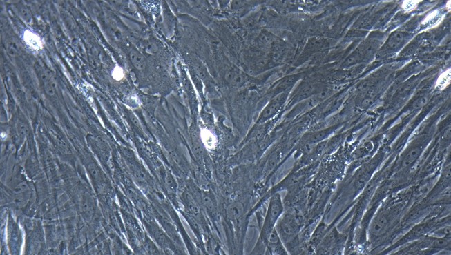 Primary Mouse Pancreatic Fibroblasts (PNF)