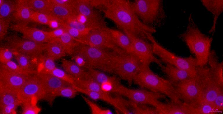 Primary Caprine Corpus Cavernosum Smooth Muscle Cells (CCSM)