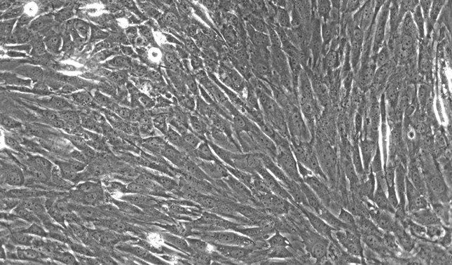 Primary Mouse Oral Mucosal Fibroblasts (OMF)