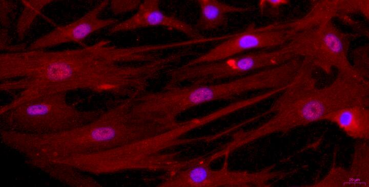 Primary Rabbit Urethral Smooth Muscle Cells (UrSMC)