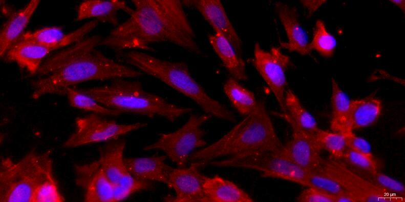 Primary Rabbit Vas Deferens Smooth Muscle Cells (VDSM)