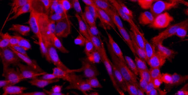 Primary Rabbit Vas Deferens Smooth Muscle Cells (VDSM)