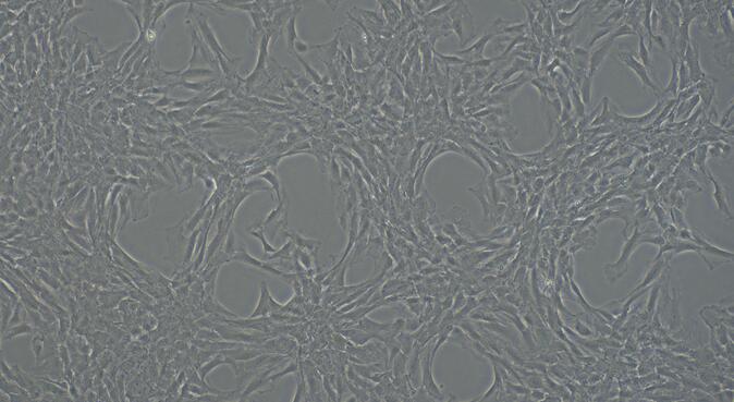 Primary Rat Femoral Artery Endothelial Cells (FAEC)