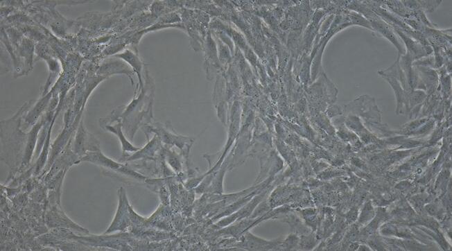 Primary Rat Femoral Artery Endothelial Cells (FAEC)