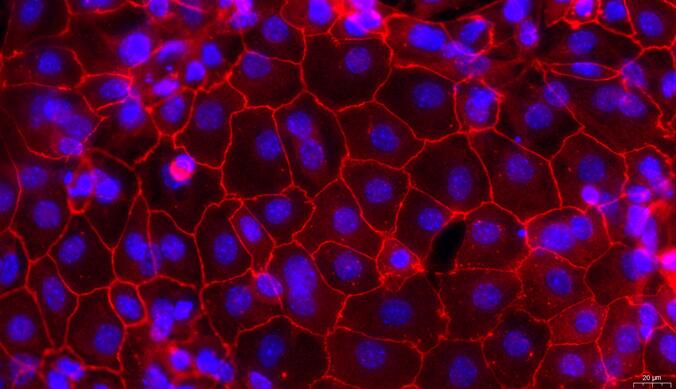 Primary Mouse Tubal Epithelial Cells (TuEC)