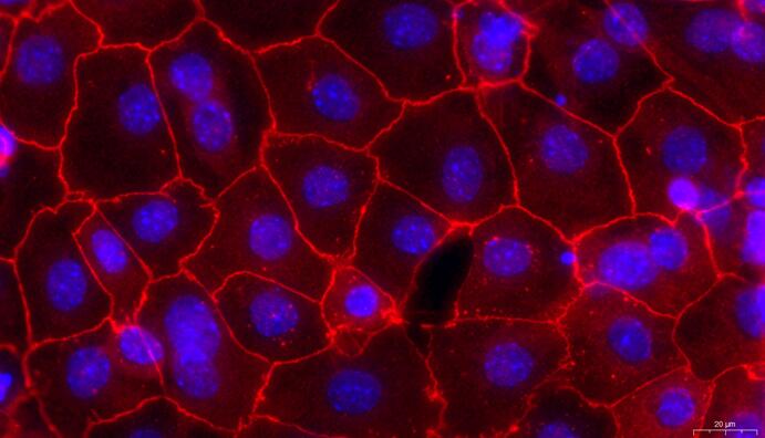 Primary Mouse Tubal Epithelial Cells (TuEC)