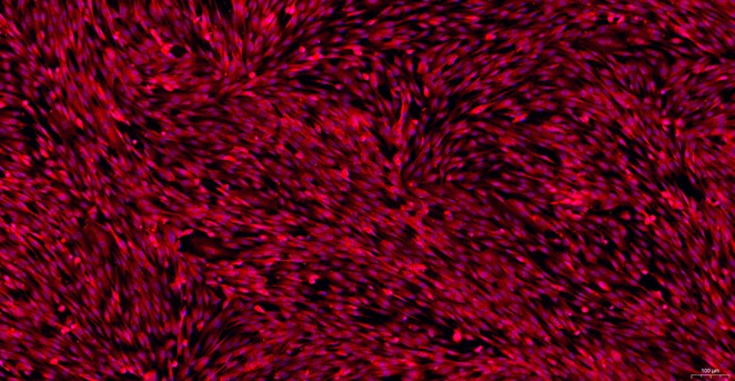 Primary Canine Epididymal Smooth Muscle Cells (EpSMC)