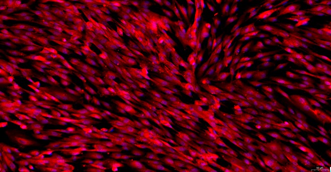 Primary Canine Epididymal Smooth Muscle Cells (EpSMC)