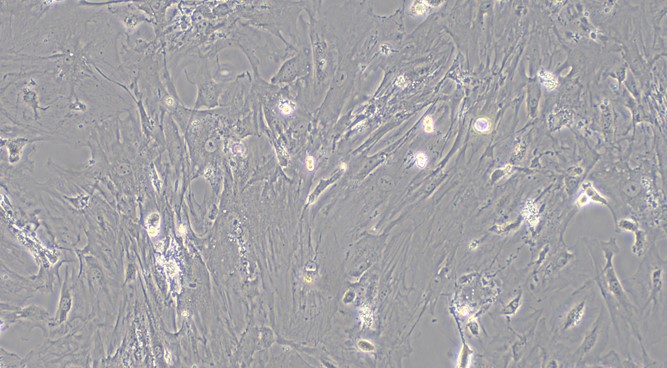Primary Mouse Seminal Vesicle Smooth Muscle Cells (SVSMC)
