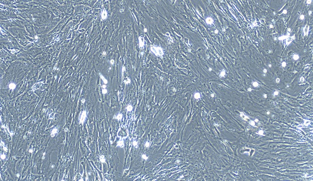 Primary Mouse Seminal Vesicle Smooth Muscle Cells (SVSMC)
