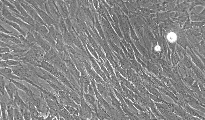Primary Rat Seminal Vesicle Smooth Muscle Cells (SVSMC)
