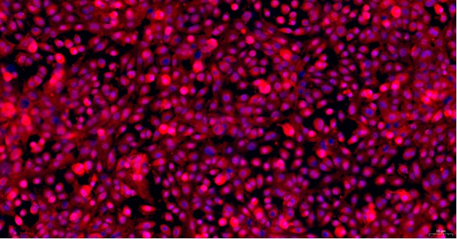 Primary Mouse Pleural Mesothelial Cells (PlMC)
