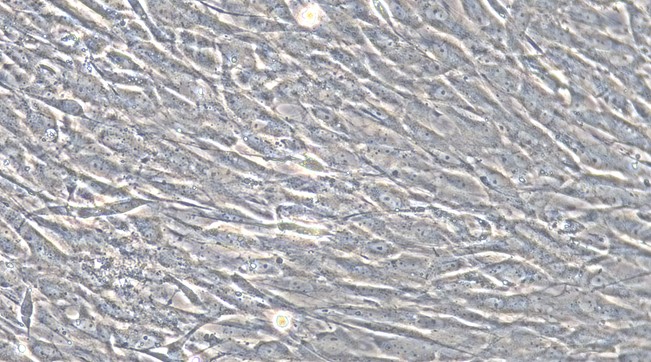 Primary Rat Peripheral Sciatic Nerve Fibroblasts ( PSNC)
