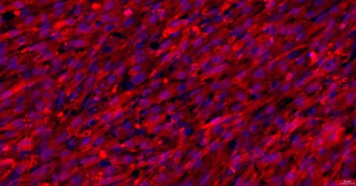 Primary Rabbit Peripheral Sciatic Nerve Fibroblasts ( PSNC)