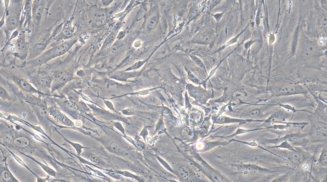 Primary Mouse Lingual Muscle Skeletal Muscle Cells (LMSMC)