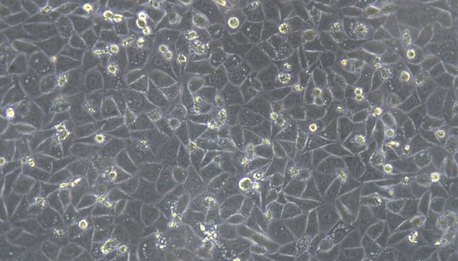 Human AGS Gastric Cancer Cells (AGS)