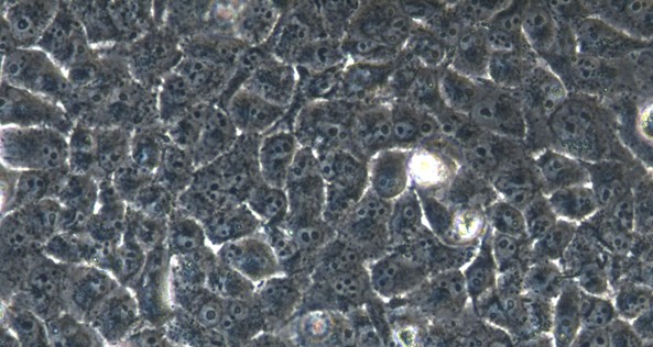 Human PANC-1 Pancreatic Cancer Cells (PANC-1)