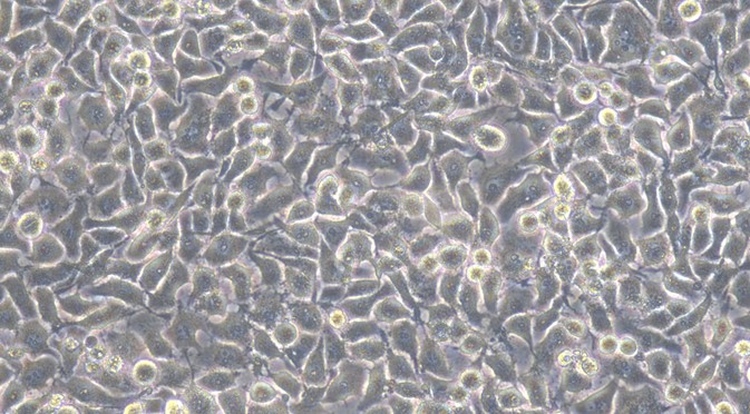 Human CNE1 Nasopharyngeal Carcinoma Cells (CNE1)
