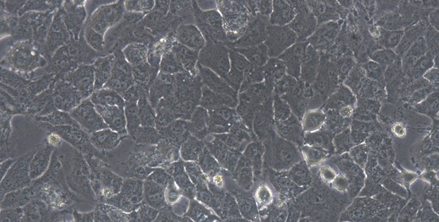 Human MHCC97-H Hepatocellular Carcinoma Cells (MHCC97-H)
