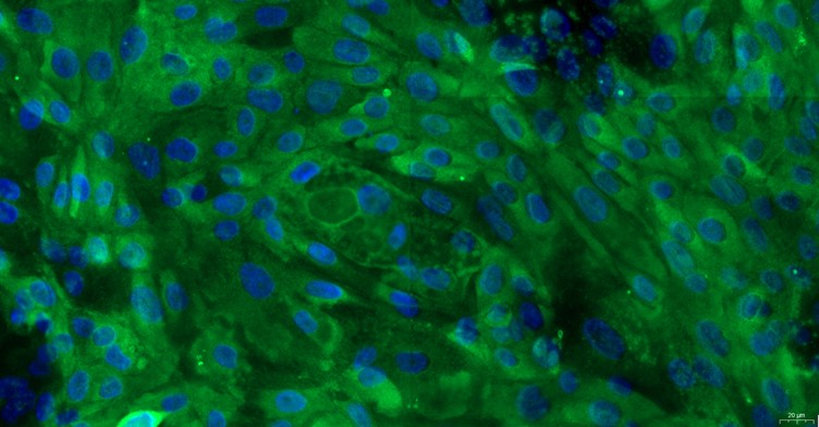 Primary Feline Oral Mucosal Epithelial Cells ( OMEC)