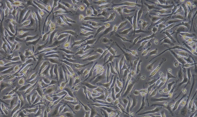 Primary Mouse Bone Marrow-Derived Macrophage Cells (BMDM)
