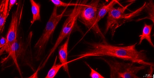 Primary Cavia Carotid Artery Endothelial Cells (CAEC)