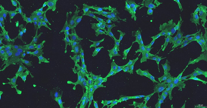 Primary Rabbit Carotid Artery Endothelial Cells (CAEC)