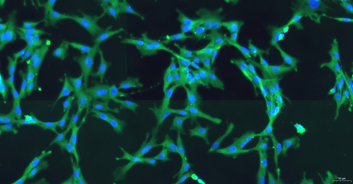 Primary Rabbit Carotid Artery Endothelial Cells (CAEC)
