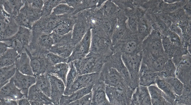Human RBE Hepatobiliary Carcinoma Cells (RBE)
