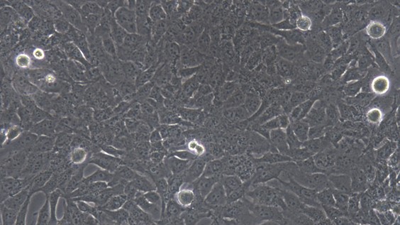 Human HTR-8/Svneo Villous Trophoblasts (HTR-8/Svneo)
